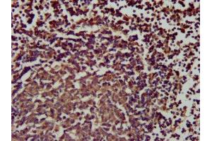 IHC image of ABIN7169782 diluted at 1:200 and staining in paraffin-embedded human lymph node tissue performed on a Leica BondTM system. (SLAMF6 anticorps  (AA 248-331))