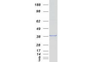 Validation with Western Blot