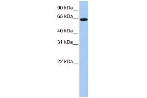 WB Suggested Anti-EPS8L1 Antibody Titration:  0. (EPS8-Like 1 anticorps  (Middle Region))