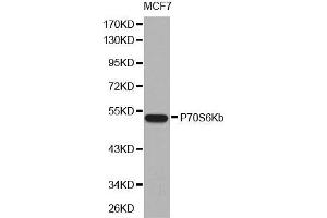 Western blot analysis of extracts of MCF7 cell line, using P70S6Kb antibody. (RPS6KB2 anticorps  (AA 1-170))