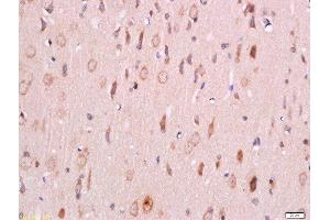 Paraformaldehyde-fixed, paraffin embedded rat brain tissue, Antigen retrieval by boiling in sodium citrate buffer (pH6) for 15min, Block endogenous peroxidase by 3% hydrogen peroxide for 30 minutes, Blocking buffer (normal goat serum) at 37°C for 20min, Antibody incubation with Rabbit Anti-PDK1(Ser241) Polyclonal Antibody, Unconjugated  at 1:200 overnight at 4°C, followed by a conjugated secondary antibody and DAB staining.