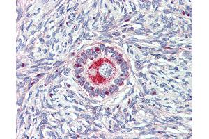 Anti-TM9SF1 antibody IHC of human ovary. (TM9SF1 anticorps  (Internal Region))