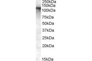 Western Blotting (WB) image for anti-Family with Sequence Similarity 91, Member A1 (FAM91A1) (N-Term) antibody (ABIN2791513)