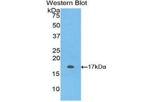 Western Blotting (WB) image for anti-S100 Protein (S100) (AA 1-94) antibody (ABIN1171951) (S100 Protein (S100) (AA 1-94) anticorps)