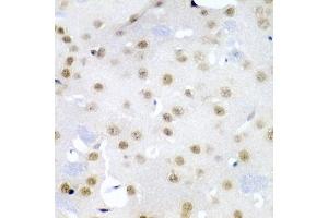 Immunohistochemistry of paraffin-embedded mouse brain using CDC27 antibody (ABIN3015756, ABIN3015757, ABIN1679113 and ABIN6219104) at dilution of 1:200 (40x lens).