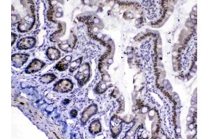 IHC analysis of MED18 using anti-MED18 antibody . (MED18 anticorps  (AA 1-208))