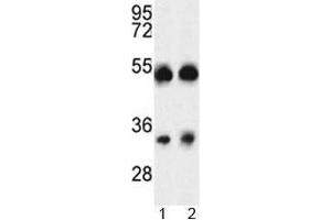 Western blot analysis of ORAI1 antibody and A375 cell line and mouse testis tissue lysate