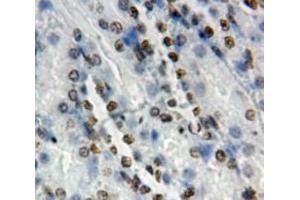 Used in DAB staining on fromalin fixed paraffin-embedded Kidney tissue (NOTCH2 anticorps  (AA 2251-2466))