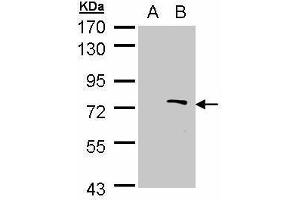 WB Image Western Blot analysis of ZMYND11 expression in transfected 293T cell line by ZMYND11 polyclonal antibody. (ZMYND11 anticorps)