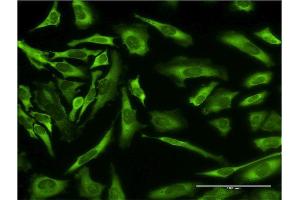 Immunofluorescence of monoclonal antibody to EPB41L3 on HeLa cell.