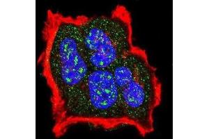 Immunofluorescence (IF) image for anti-Tuberous Sclerosis 2 (TSC2) (pSer1420) antibody (ABIN3001840) (Tuberin anticorps  (pSer1420))