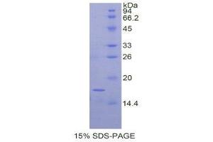 SDS-PAGE (SDS) image for Metalloproteinase Inhibitor 2 (TIMP2) (AA 33-153) protein (His tag) (ABIN2122226) (TIMP2 Protein (AA 33-153) (His tag))