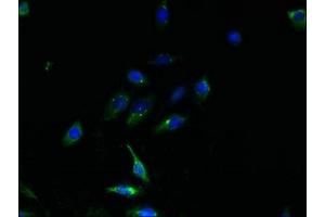 Immunofluorescent analysis of HepG2 cells using ABIN7164800 at dilution of 1:100 and Alexa Fluor 488-congugated AffiniPure Goat Anti-Rabbit IgG(H+L) (TMEM159 anticorps  (AA 1-54))