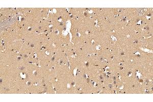 Detection of PCPE2 in Porcine Cerebrum Tissue using Polyclonal Antibody to Procollagen C Proteinase Enhancer 2 (PCPE2)