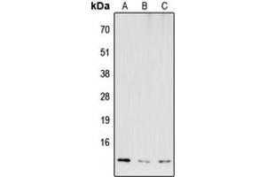 Western blot analysis of COX6B2 expression in HEK293T (A), NS-1 (B), H9C2 (C) whole cell lysates.