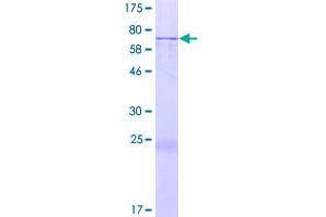 Image no. 1 for Four Jointed Box 1 (FJX1) (AA 1-437) protein (GST tag) (ABIN1354109)