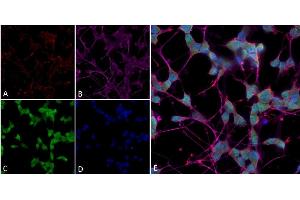 Immunocytochemistry/Immunofluorescence analysis using Mouse Anti-Thyroid Hormone Receptor Monoclonal Antibody, Clone H43 (ABIN6952047). (THRA anticorps  (Atto 594))