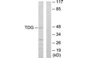 Western blot analysis of extracts from Jurkat cells, using TDG Antibody. (TDG anticorps  (AA 31-80))