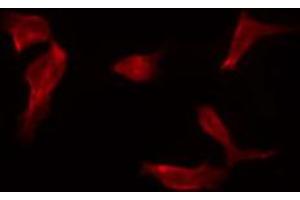 ABIN6267230 staining HepG2 by IF/ICC. (IKK-alpha /IKK-beta anticorps  (pSer180, pSer181))