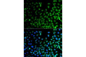 Immunofluorescence analysis of A549 cells using LHX6 antibody (ABIN6290564).