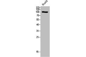 Western Blot analysis of HepG2 cells using PI 3-Kinase p110δ Polyclonal Antibody (PIK3CD anticorps  (N-Term))