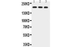 Anti-BRCA1 Picoband antibody,  All lanes: Anti-BRCA1 at 0.