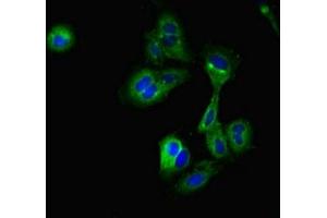 Immunofluorescent analysis of Hela cells using ABIN7149055 at dilution of 1:100 and Alexa Fluor 488-congugated AffiniPure Goat Anti-Rabbit IgG(H+L) (CRIP2 anticorps  (AA 1-208))