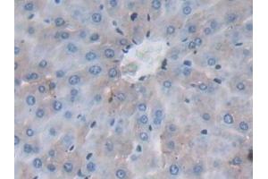 Detection of JNK1 in Rat Liver Tissue using Polyclonal Antibody to c-Jun N-terminal Kinase 1 (JNK1)