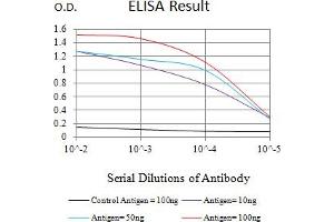 Black line: Control Antigen (100 ng),Purple line: Antigen (10 ng), Blue line: Antigen (50 ng), Red line:Antigen (100 ng)