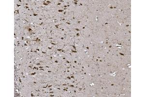 IHC analysis of CISD2 using anti-CISD2 antibody (ABIN7602010). (CISD2 anticorps  (AA 55-124))