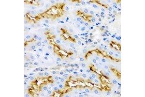 Immunohistochemical analysis of Aminoacylase 1 staining in rat kidney formalin fixed paraffin embedded tissue section. (Aminoacylase 1 anticorps)