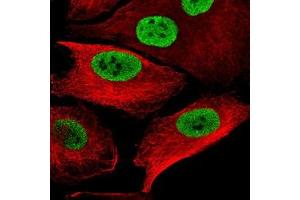 Immunofluorescence staining of WM-115 cell with antibody shows specific staining in the nucleoplasm in green. (SOX10 anticorps)