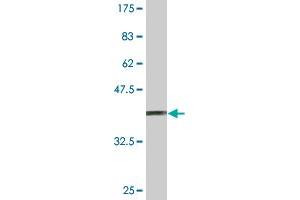 Western Blot detection against Immunogen (37. (SUPT5H anticorps  (AA 981-1087))