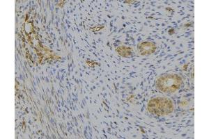 ABIN6277527 at 1/100 staining Human uterus tissue by IHC-P. (C1QB anticorps  (Internal Region))