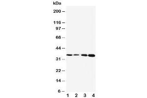 Western blot testing of Protein C antibody and Lane 1:  Jurkat (PROC anticorps  (AA 446-461))