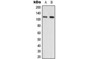 Western blot analysis of NNT expression in HEK293T (A), NIH3T3 (B) whole cell lysates. (NNT anticorps  (Center))