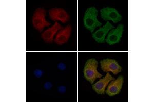 ABIN6259736 and ABIN6279069 staining Hela cells by IF/ICC.