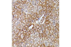 Immunohistochemistry of paraffin-embedded mouse liver using HDLBP antibody (ABIN6128051, ABIN6141701, ABIN6141702 and ABIN6221672) at dilution of 1:100 (40x lens).