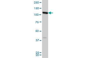 Western Blotting (WB) image for anti-Coiled-Coil Domain Containing 132 (CCDC132) (AA 862-965) antibody (ABIN961368) (Syndetin/VPS50 anticorps  (AA 862-965))
