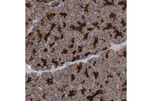 Immunohistochemical staining (Formalin-fixed paraffin-embedded sections) of human pancreas with BAIAP3 polyclonal antibody  shows strong positivity in ductal cells at 1:200-1:500 dilution. (BAIAP3 anticorps)