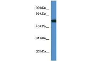 Image no. 1 for anti-Tigger Transposable Element Derived 4 (TIGD4) (AA 110-159) antibody (ABIN6746364) (TIGD4 anticorps  (AA 110-159))