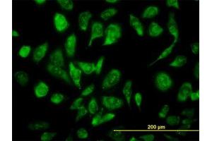 Image no. 3 for anti-Nuclear Receptor Coactivator 4 (NCOA4) (AA 505-615) antibody (ABIN599026) (NCOA4 anticorps  (AA 505-615))