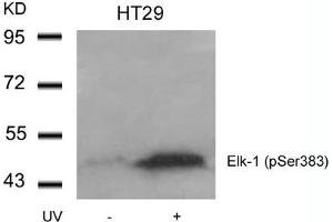 Western blot analysis of extracts from HT29 cells untreated or treated with UV using Elk-1(Phospho-Ser383) Antibody. (ELK1 anticorps  (pSer383))