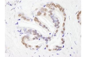 Immunohistochemistry (IHC) image for anti-RNA Binding Motif Protein 26 (RBM26) (AA 200-250) antibody (ABIN7448763) (RBM26 anticorps  (AA 200-250))