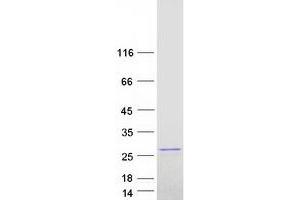 Validation with Western Blot