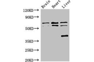 Western Blot Positive WB detected in: Mouse brain tissue, Rat heart tissue, Rat liver tissue All lanes: TRAF3IP3 antibody at 2. (TRAF3IP3 anticorps  (AA 74-185))