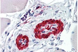 Human Vessels: Formalin-Fixed, Paraffin-Embedded (FFPE)