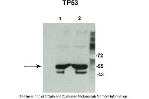 Sample Type: 1. (p53 anticorps  (N-Term))