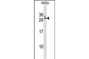 Western blot analysis in WiDr cell line lysates (35ug/lane). (GTF2F2 anticorps  (AA 144-172))