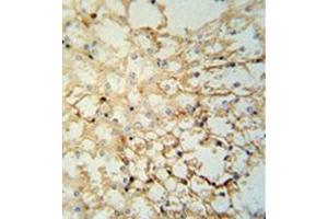 Immunohistochemistry analysis in formalin fixed and paraffin embedded mouse kidney tissue reacted with LYPD1 Antibody (C-term) followed which was peroxidase conjugated to the secondary antibody and followed by DAB staining. (LYPD1 anticorps  (C-Term))